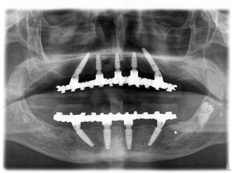 Thorpe Dental Implant Centre